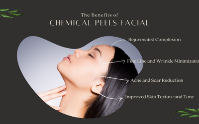 Chemical Peels Unveiling Radiant Skin