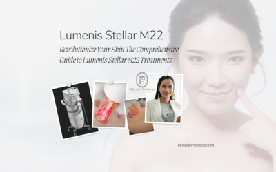 Revolutionize Your Skin The Comprehensive Guide to Lumenis Stellar M22 Treatments