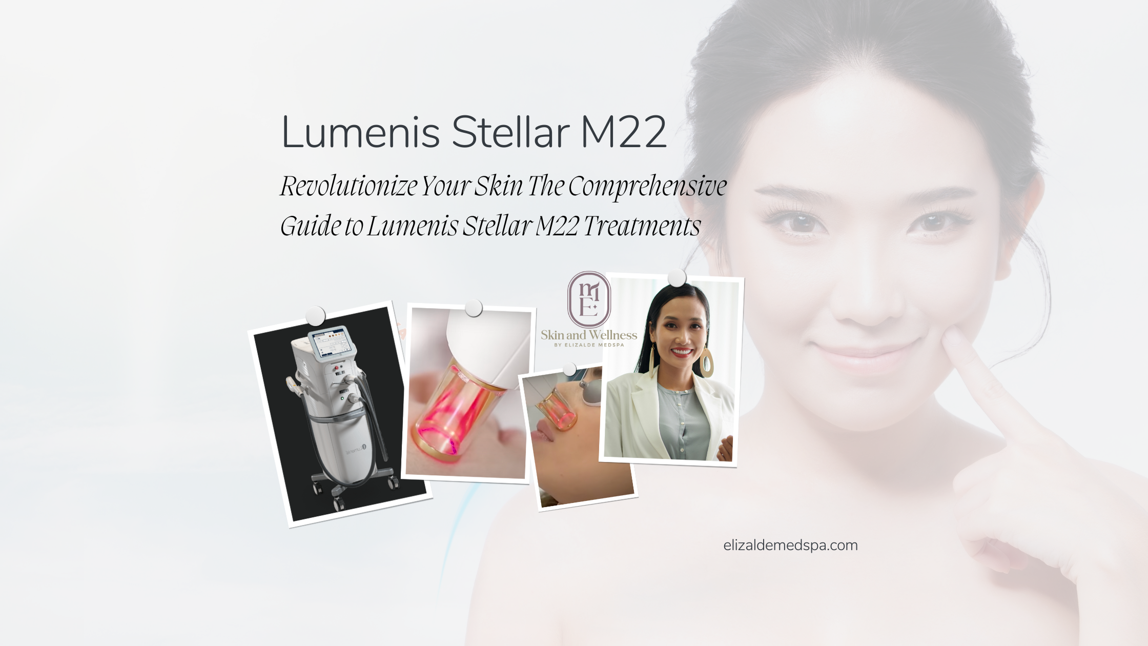 Revolutionize Your Skin The Comprehensive Guide to Lumenis Stellar M22 Treatments Revolutionize Your Skin The Comprehensive Guide to Lumenis Stellar M22 Treatments